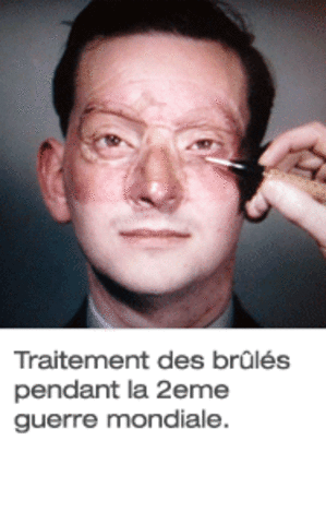 Réparations après 14-18