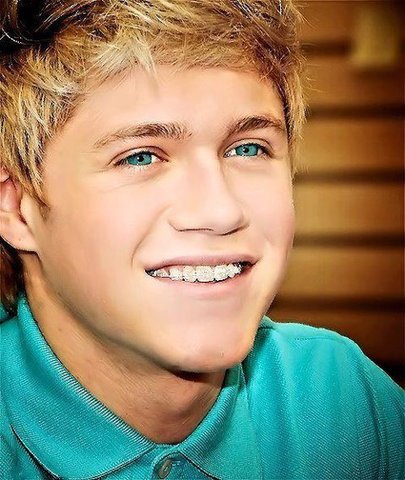 NIall got braces