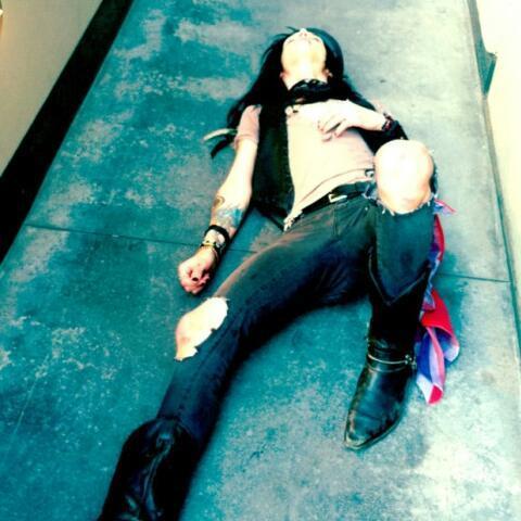 Andy broke his ribs.