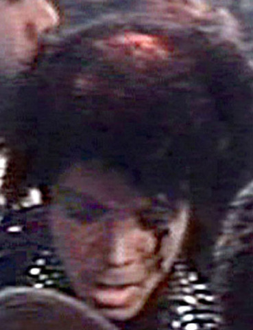 Plastic surgery Began