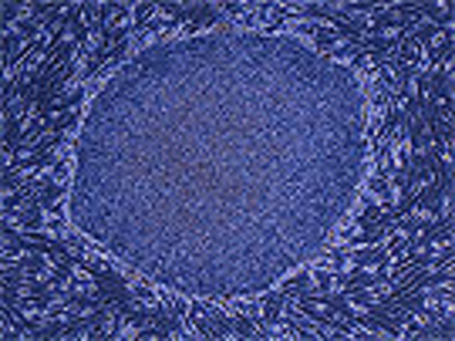 Induction of Pluripotent Stem Cells from Mouse Embryonic and Adult Fibroblast Cultures by Defined Factors