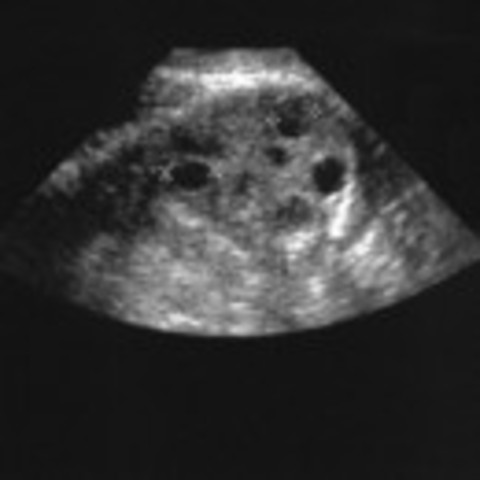 0-4 weeks after conception