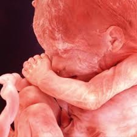 Month 4- Fetus