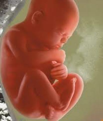 Month 6- Fetus