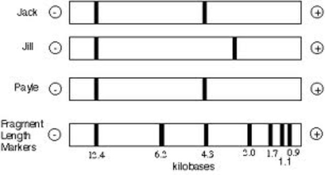 Restriction Fragment Length Polymorphism
