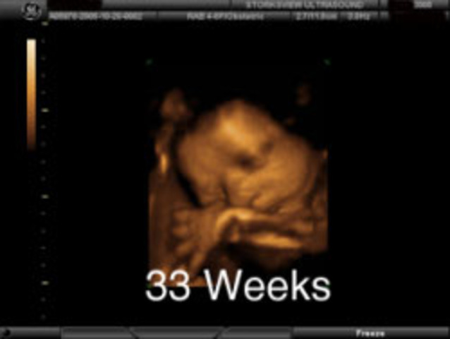 33 Weeks