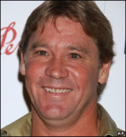 Man got stinged by stingray and survived