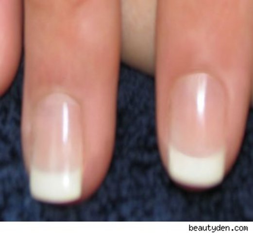 The French bring it in