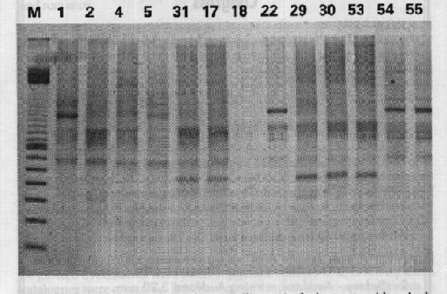 Restriction Fragment Length Polymorphism (RFLP) discovered