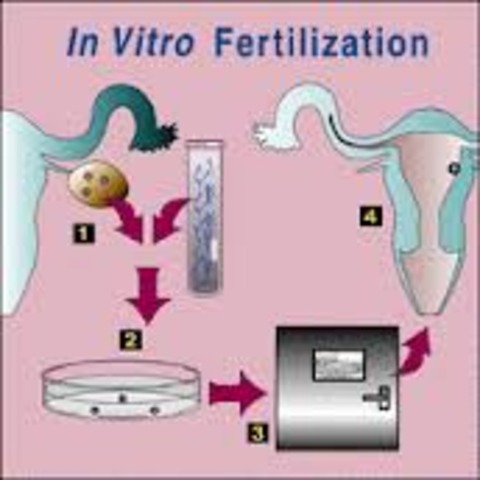 virto fertilization
