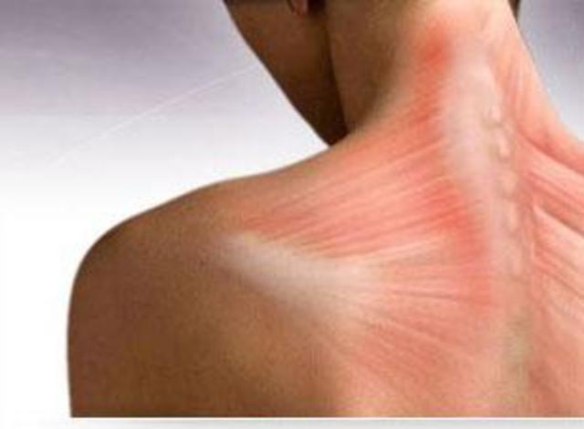 Botox is Used for Cervical Dystonia