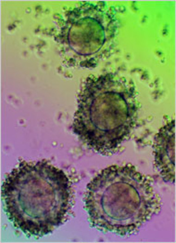 First to derive stem cells