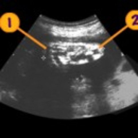 33-36 weeks after conception