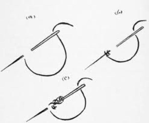 Got stiches in my finger