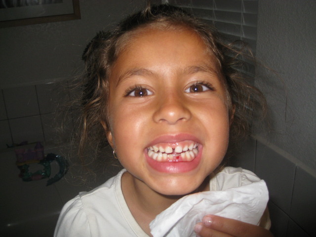 Lost my first tooth