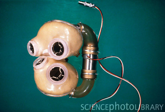 Permanent Artificial Heart
