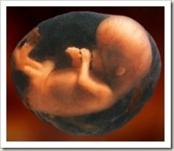 8 week fetus