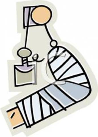 When I sprained my foot