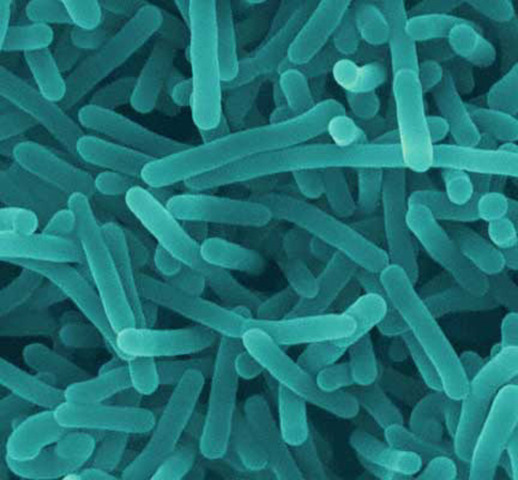 What Is Listeria