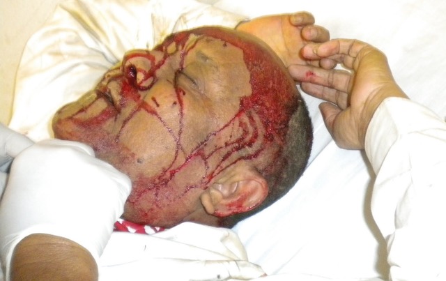 Was seriously wounded by artillery Austrian.