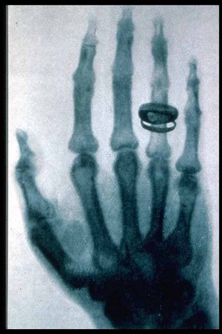 Discovered X-Rays