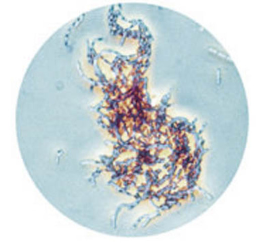 Descubrimiento del ántrax