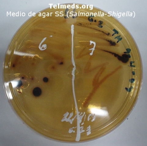 Introducción de los indicadores de PH en los medios de cultivo
