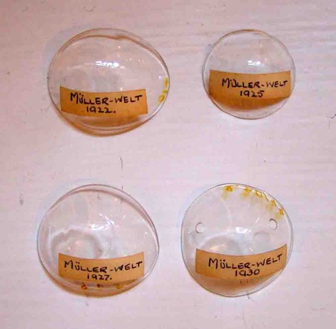 First contact lenses developed