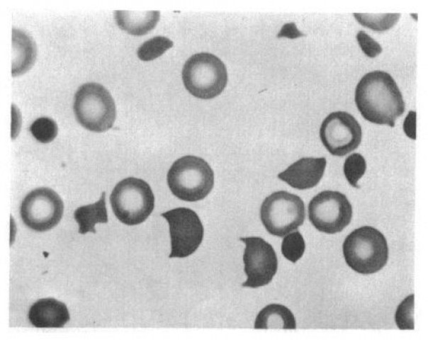 Development of the “Ham Test”