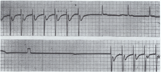 Restarting the Heart