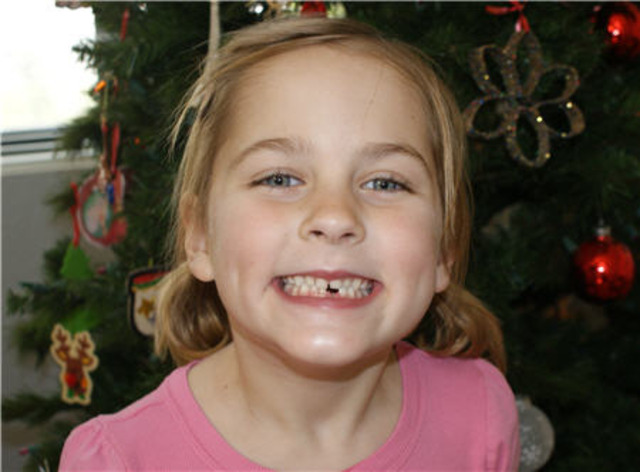 When I Lost My First Tooth