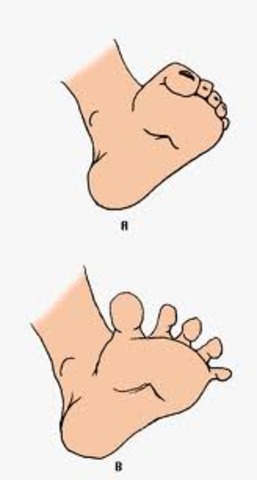 Reflex abilities- Babinski reflex and Moro reflex.