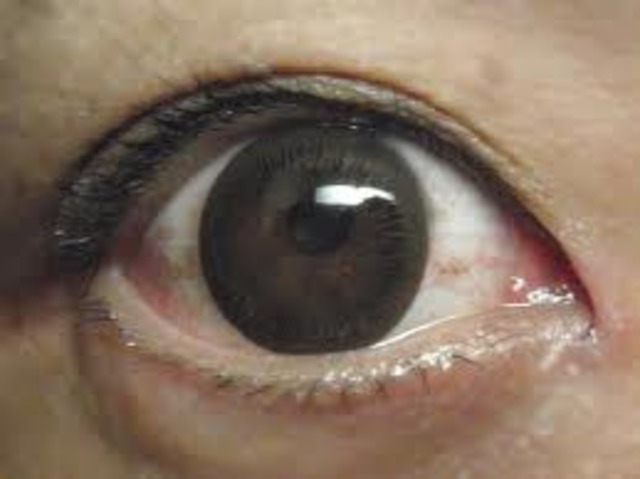 Contacts are now more comfortable.