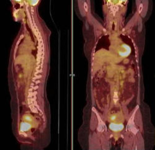 Advanced Body Imaging