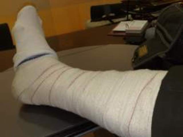 he broke his foot in an accident, so it was impossible for him to follow his dream.