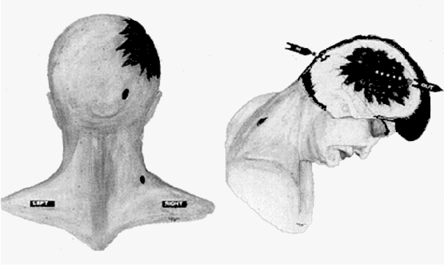 The Warren Commision report was released to the people