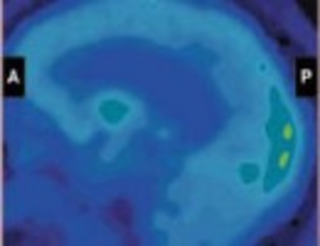 The Dead Donor Rule and Organ Transplantation