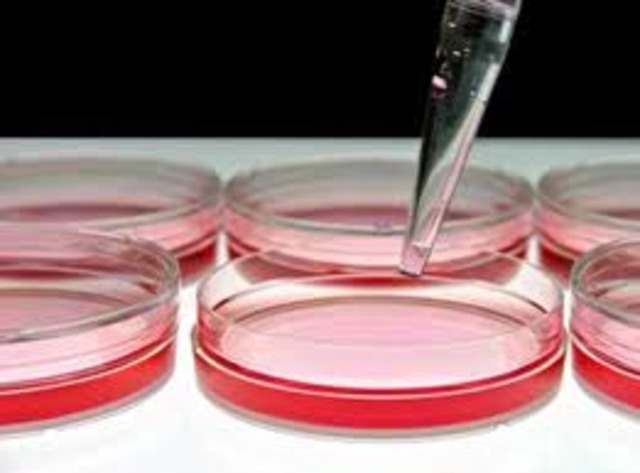 Robert Koch Develops the Culture Plate Method to Identify Pathogens