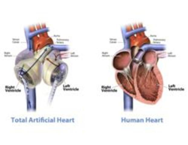 Temporary Artificial Heart