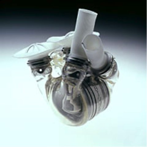 AbioCor Implantable Replacement Heart