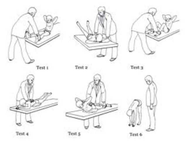 Kraus-Weber Test implies health status of kids