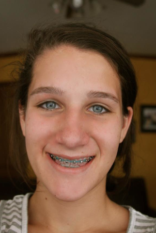 Lexington and Concord