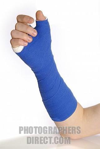 Fractured Wrist