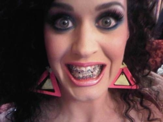 I Was Struck In the Mouth With A Hockey Stick This