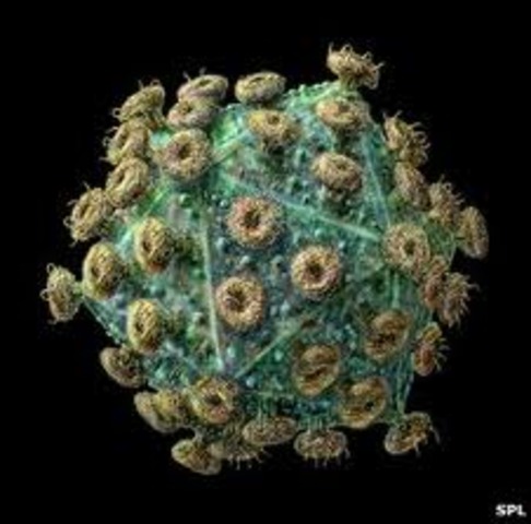 First known case of HIV
