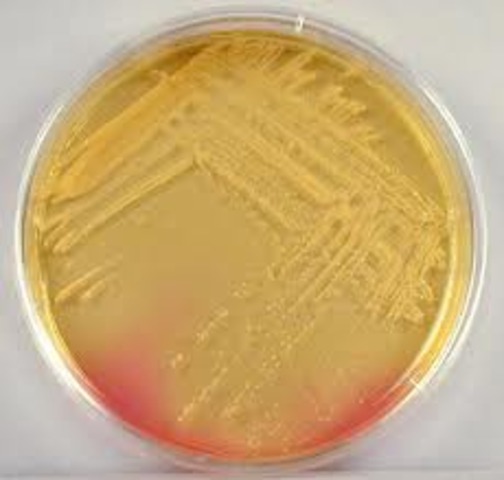 Staphylococcus aureus