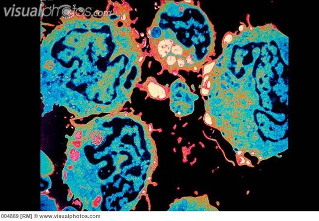 Abbe designes an objective that incorporates red, yellow, and blue into focus. Lense requires 10 or more elements.