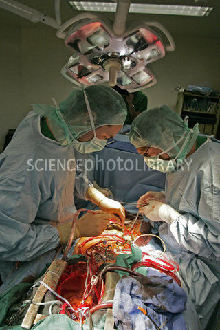 First Heart Transplant