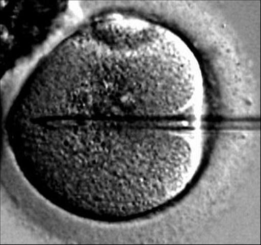 The Concept of IVF