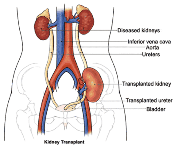 Gertrude Elion patented a leukemia-fighting drugDr. Joseph E. Murray performs the first kidney transplant